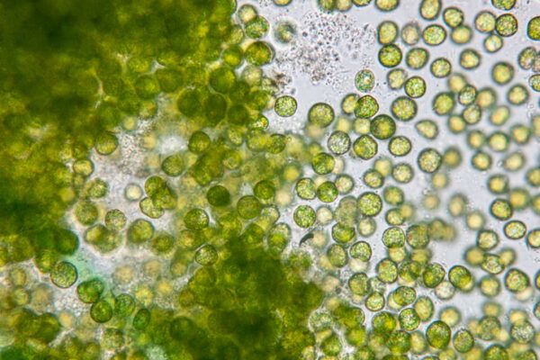 Chlorella, a protein-rich algae, under the microscope in a lab